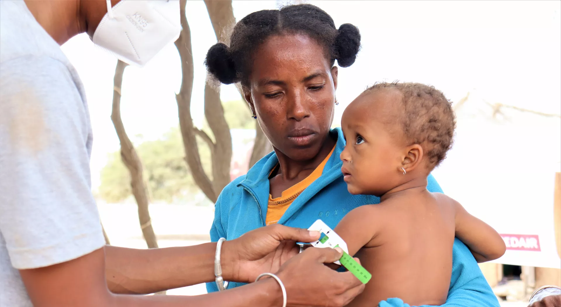 Nahrungsmittelkrise: Medair-Mitarbeiter misst den Arm eines unterernährten Kindes